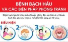 Công điện số 68/CĐ-TTg ngày 13/7/2024 của Thủ tướng Chính phủ về tăng cường công tác phòng, chống bệnh Bạch hầu